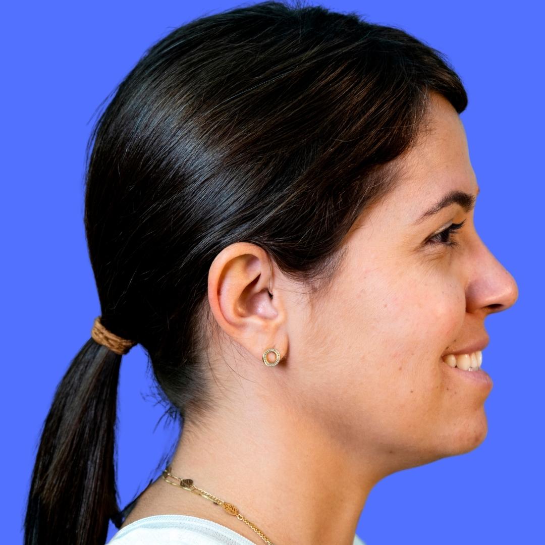 Sintomas de perda auditiva